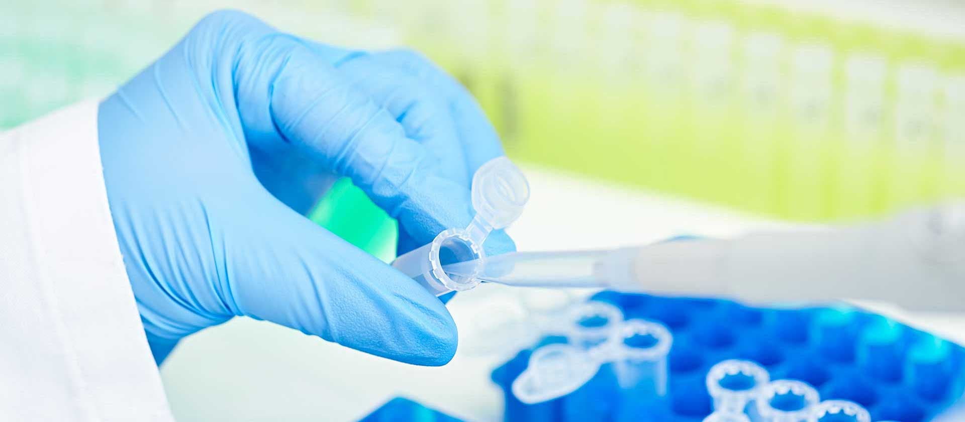 Laborant in blauen Handschuhen pipettiert in Teströhrchen, die in blauen Halterungen stehen.